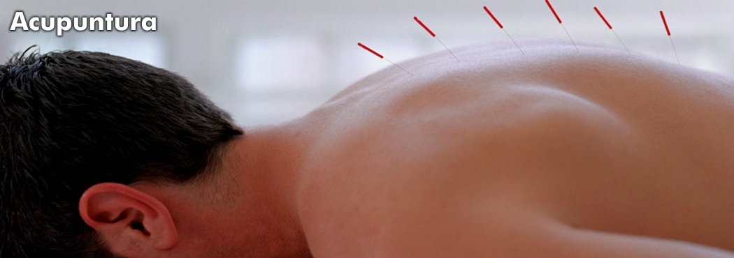 ACUPUNTURA